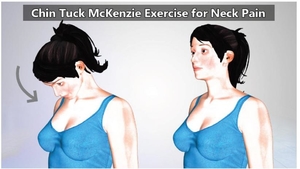 Chin Tuck McKenzie Exercise for Neck